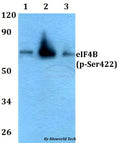 Western blot (WB) analysis of p-eIF4B (Ser422) polyclonal antibody at 1:500 dilution
Lane1:HEK293T whole cell lysate
Lane2:Raw264.7 whole cell lysate
Lane3:PC12 whole cell lysate