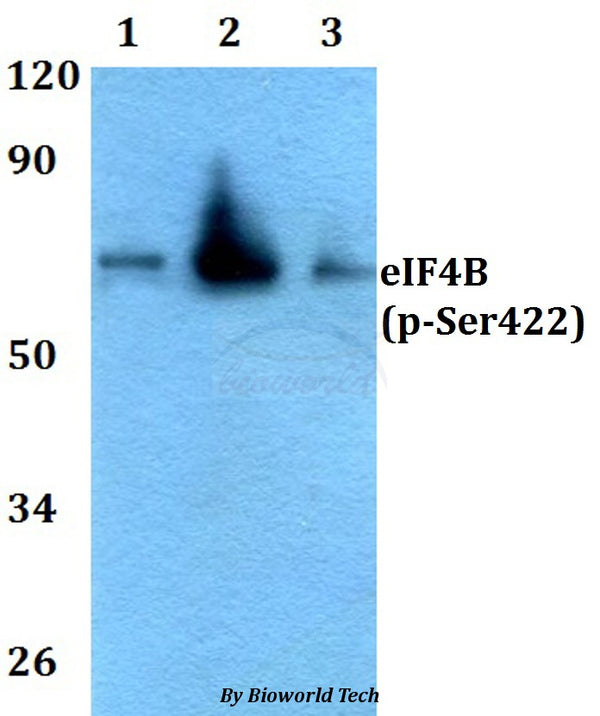 Western blot (WB) analysis of p-eIF4B (Ser422) polyclonal antibody at 1:500 dilution
Lane1:HEK293T whole cell lysate
Lane2:Raw264.7 whole cell lysate
Lane3:PC12 whole cell lysate