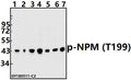 Western blot (WB) analysis of p-NPM (T199) pAb at 1:500 dilution
Lane1:H1792 whole cell lysate(40ug)
Lane2:A549 whole cell lysate(40ug)
Lane3:SGC7901 whole cell lysate(40ug)
Lane4:EC9706 whole cell lysate(40ug)
Lane5:PC12 whole cell lysate(40ug)
Lane6:CT26 whole cell lysate(40ug)
Lane7:HEK293T whole cell lysate(40ug)