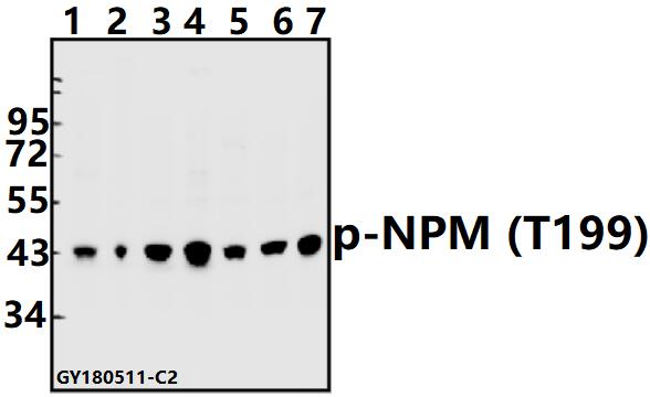 Western blot (WB) analysis of p-NPM (T199) pAb at 1:500 dilution
Lane1:H1792 whole cell lysate(40ug)
Lane2:A549 whole cell lysate(40ug)
Lane3:SGC7901 whole cell lysate(40ug)
Lane4:EC9706 whole cell lysate(40ug)
Lane5:PC12 whole cell lysate(40ug)
Lane6:CT26 whole cell lysate(40ug)
Lane7:HEK293T whole cell lysate(40ug)