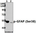 Western blot (WB) analysis of p-GFAP (Ser38) pAb at 1:500 dilution
Lane1:The Brain tissue lysate of Rat (30ug)
Lane2:The Brain tissue lysate of Mouse (40ug)