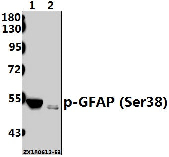 Western blot (WB) analysis of p-GFAP (Ser38) pAb at 1:500 dilution
Lane1:The Brain tissue lysate of Rat (30ug)
Lane2:The Brain tissue lysate of Mouse (40ug)
