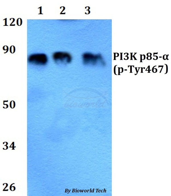 Western blot (WB) analysis of p-PI3K p85-α/p55γ (Tyr467/199) polyclonal antibody at 1:500 dilution
Lane1:HEK293T whole cell lysate
Lane2:sp2/0 whole cell lysate
Lane3:PC12 whole cell lysate