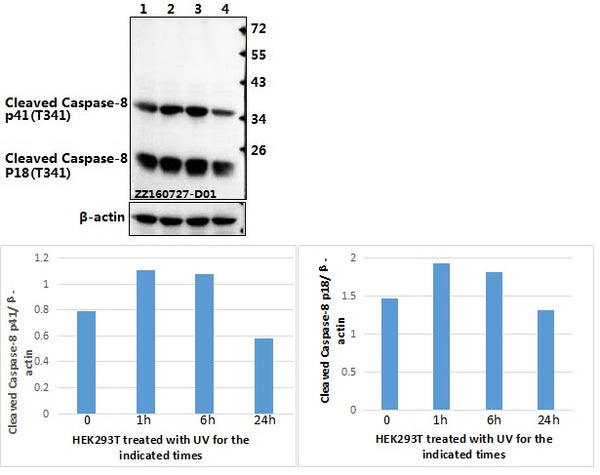 Western blot (WB) analysis of p-Caspase-8 (T341) polyclonal antibody at 1:500 dilution
Lane1:HEK293T whole cell lysate(40ug)
Lane2:HEK293T treated with UV for 1h whole cell lysate(40ug)
Lane3:HEK293T treated with UV for 6h whole cell lysate(40ug)
Lane4:HEK293T treated with UV for 24h whole cell lysate(40ug)