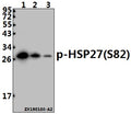 Western blot (WB) analysis of p-HSP27(S82) pAb at 1:500 dilution
Lane1:HepG2 whole cell lysate(40ug)
Lane2:SK-OVCAR3 whole cell lysate(40ug)
Lane3:A375 whole cell lysate(40ug)