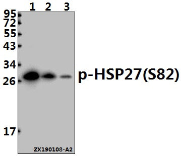 Western blot (WB) analysis of p-HSP27(S82) pAb at 1:500 dilution
Lane1:HepG2 whole cell lysate(40ug)
Lane2:SK-OVCAR3 whole cell lysate(40ug)
Lane3:A375 whole cell lysate(40ug)