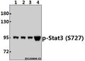 Western blot (WB) analysis of p-Stat3 (S727) pAb at 1:2000 dilution
Lane1:Hela whole cell lysate(40ug)
Lane2:MCF-7 whole cell lysate(40ug)
Lane3:AML-12 whole cell lysate(40ug)
Lane4:C6 whole cell lysate(40ug)