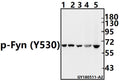 Western blot (WB) analysis of p-Fyn (Y530)  pAb at 1:500 dilution
Lane1:HEK293T whole cell lysate(10ug)
Lane2:U-87MG whole cell lysate(10ug)
Lane3:HepG2 whole cell lysate(20ug)
Lane4:C6 whole cell lysate(40ug)
Lane5:BV2 whole cell lysate(40ug)