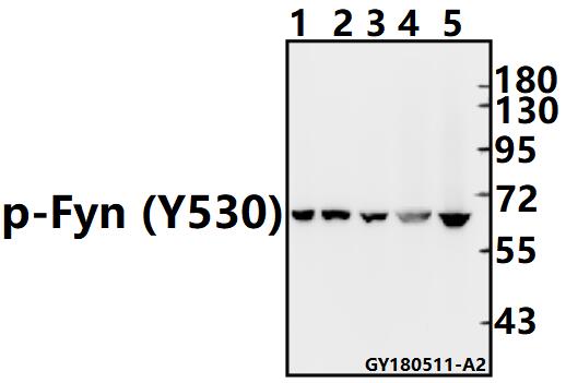 Western blot (WB) analysis of p-Fyn (Y530)  pAb at 1:500 dilution
Lane1:HEK293T whole cell lysate(10ug)
Lane2:U-87MG whole cell lysate(10ug)
Lane3:HepG2 whole cell lysate(20ug)
Lane4:C6 whole cell lysate(40ug)
Lane5:BV2 whole cell lysate(40ug)