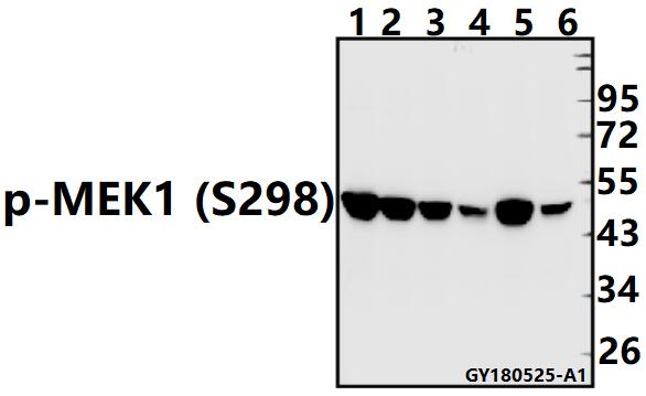 Western blot (WB) analysis of p-MEK1 (S298) pAb at 1:500 dilution
Lane1:PC12 whole cell lysate(40ug)
Lane2:CT26 whole cell lysate(40ug)
Lane3:H1792 whole cell lysate(40ug)
Lane4:LOVO whole cell lysate(40ug)
Lane5:SGC7901 whole cell lysate(40ug)
Lane6:HCT116 whole cell lysate(40ug)