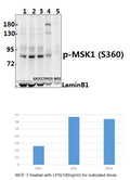 Western blot (WB) analysis of p-MSK1 (S360) polyclonal antibody at 1:500 dilution
Lane1:MCF-7 whole cell lysate
Lane2:MCF-7 treated with LPS(100ng/ml) for 5 minutes whole cell lysate
Lane3:MCF-7 treated with LPS(100ng/ml) for 30 minutes whole cell lysate
Lane4:AML-12 whole cell lysate(40ug)
Lane5:H9C2 whole cell lysate(40ug)