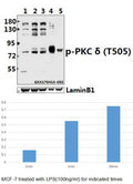 Western blot (WB) analysis of PKC δ (phospho-T505) polyclonal antibody at 1:500 dilution
Lane1:MCF-7 whole cell lysate
Lane2:MCF-7 treated with LPS(100ng/ml) for 5 minutes whole cell lysate
Lane3:MCF-7 treated with LPS(100ng/ml) for 30 minutes whole cell lysate
Lane4:BV2 whole cell lysate(40ug)
Lane5:PC12 whole cell lysate(40ug)
