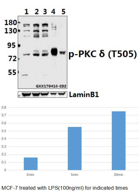 Western blot (WB) analysis of PKC δ (phospho-T505) polyclonal antibody at 1:500 dilution
Lane1:MCF-7 whole cell lysate
Lane2:MCF-7 treated with LPS(100ng/ml) for 5 minutes whole cell lysate
Lane3:MCF-7 treated with LPS(100ng/ml) for 30 minutes whole cell lysate
Lane4:BV2 whole cell lysate(40ug)
Lane5:PC12 whole cell lysate(40ug)