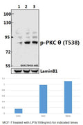 Western blot (WB) analysis of PKC θ (phospho-T538) polyclonal antibody at 1:500 dilution
Lane1:MCF-7 whole cell lysate
Lane2:MCF-7 treated with LPS(100ng/ml) for 5 minutes whole cell lysate
Lane3:MCF-7 treated with LPS(100ng/ml) for 30 minutes whole cell lysate