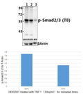 Western blot (WB) analysis of Smad2/3 (phospho-T8) polyclonal antibody at 1:500 dilution
Lane1:HEK293T whole cell lysate
Lane2:HEK293T treated with TNFα(20ng/ml)for 10 min whole cell lysate
Lane3:The Heart tissue lysate of Mouse
