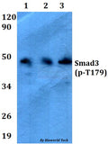 Western blot (WB) analysis of p-Smad3 (T179) polyclonal antibody at 1:500 dilution
Lane1:HEK293T cell lysate treated with TNFa(20ng/ml,15mins)
Lane2:Raw264.7 cell lysate treated with TNFa(20ng/ml,15mins)
Lane3:PC12 cell lysate treated with TNFa(20ng/ml,15mins)