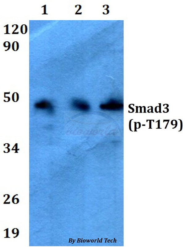Western blot (WB) analysis of p-Smad3 (T179) polyclonal antibody at 1:500 dilution
Lane1:HEK293T cell lysate treated with TNFa(20ng/ml,15mins)
Lane2:Raw264.7 cell lysate treated with TNFa(20ng/ml,15mins)
Lane3:PC12 cell lysate treated with TNFa(20ng/ml,15mins)