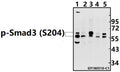 Western blot (WB) analysis of p-Smad3 (S204) pAb at 1:500 dilution
Lane1:CT26 whole cell lysate(40ug)
Lane2:C6 whole cell lysate(40ug)
Lane3:H1792 whole cell lysate(40ug)
Lane4:A375 whole cell lysate(40ug)
Lane5:Hela whole cell lysate(40ug)