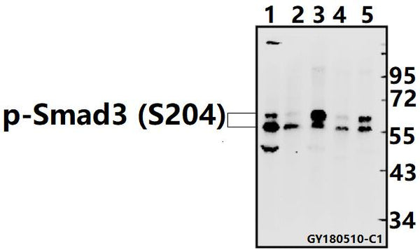 Western blot (WB) analysis of p-Smad3 (S204) pAb at 1:500 dilution
Lane1:CT26 whole cell lysate(40ug)
Lane2:C6 whole cell lysate(40ug)
Lane3:H1792 whole cell lysate(40ug)
Lane4:A375 whole cell lysate(40ug)
Lane5:Hela whole cell lysate(40ug)