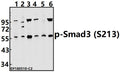 Western blot (WB) analysis of p-Smad3 (S213) pAb at 1:500 dilution
Lane1:Hela whole cell lysate(40ug)
Lane2:HEK293T whole cell lysate(40ug)
Lane3:Panc1 whole cell lysate(20ug)
Lane4:LOVO whole cell lysate(40ug)
Lane5:C6 whole cell lysate(40ug)
Lane6:AML-12 whole cell lysate(40ug)