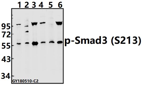 Western blot (WB) analysis of p-Smad3 (S213) pAb at 1:500 dilution
Lane1:Hela whole cell lysate(40ug)
Lane2:HEK293T whole cell lysate(40ug)
Lane3:Panc1 whole cell lysate(20ug)
Lane4:LOVO whole cell lysate(40ug)
Lane5:C6 whole cell lysate(40ug)
Lane6:AML-12 whole cell lysate(40ug)