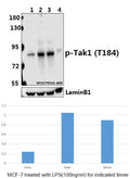 Western blot (WB) analysis of Tak1 (phospho-T184) polyclonal antibody at 1:500 dilution
Lane1:MCF-7 whole cell lysate
Lane2:MCF-7 treated with LPS(100ng/ml) for 5 minutes whole cell lysate
Lane3:MCF-7 treated with LPS(100ng/ml) for 30 minutes whole cell lysate
Lane4:The Spleen tissue lysate of Mouse(40ug)