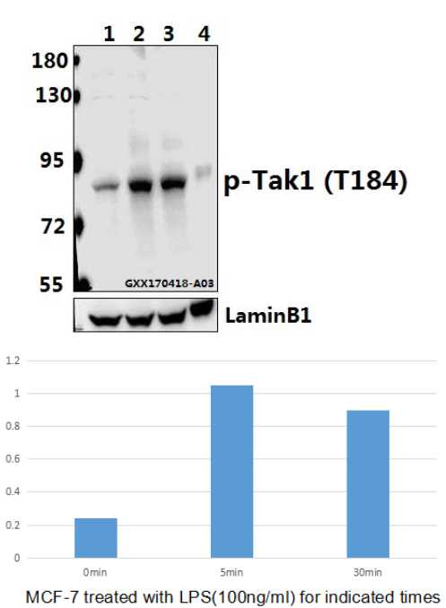 Western blot (WB) analysis of Tak1 (phospho-T184) polyclonal antibody at 1:500 dilution
Lane1:MCF-7 whole cell lysate
Lane2:MCF-7 treated with LPS(100ng/ml) for 5 minutes whole cell lysate
Lane3:MCF-7 treated with LPS(100ng/ml) for 30 minutes whole cell lysate
Lane4:The Spleen tissue lysate of Mouse(40ug)