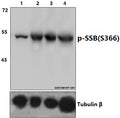 Western blot (WB) analysis of p-SSB (S366) polyclonal antibody at 1:1000 dilution
Lane1:HEK293T whole cell lysate
Lane2:HEK293T treated with EGF(0.1ng/ml,15min) whole cell lysate
Lane3:HEK293T treated with EGF(0.1ng/ml,30min) whole cell lysate
Lane4:HEK293T treated with EGF(0.1ng/ml,60min) whole cell lysate