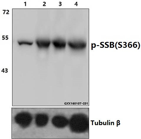 Western blot (WB) analysis of p-SSB (S366) polyclonal antibody at 1:1000 dilution
Lane1:HEK293T whole cell lysate
Lane2:HEK293T treated with EGF(0.1ng/ml,15min) whole cell lysate
Lane3:HEK293T treated with EGF(0.1ng/ml,30min) whole cell lysate
Lane4:HEK293T treated with EGF(0.1ng/ml,60min) whole cell lysate