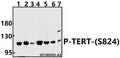 Western blot (WB) analysis of TERT (phospho-S824) polyclonal antibody at 1:500 dilution
Lane1:A549 whole cell lysate(40ug)
Lane2:H1792 whole cell lysate(40ug)
Lane3:HepG2 whole cell lysate(40ug)
Lane4:Panc1 whole cell lysate(40ug)
Lane5:K562 whole cell lysate(40ug)
Lane6: The Thymus tissue lysate of Rat(40ug)
Lane7: The Lung tissue lysate of Mouse(40ug)