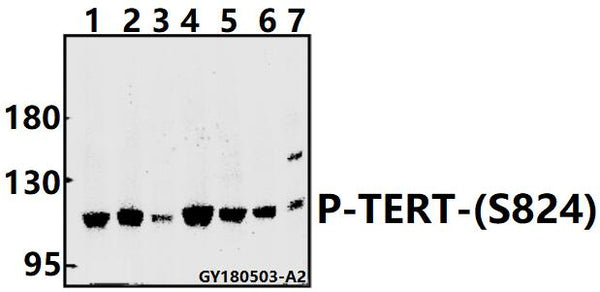 Western blot (WB) analysis of TERT (phospho-S824) polyclonal antibody at 1:500 dilution
Lane1:A549 whole cell lysate(40ug)
Lane2:H1792 whole cell lysate(40ug)
Lane3:HepG2 whole cell lysate(40ug)
Lane4:Panc1 whole cell lysate(40ug)
Lane5:K562 whole cell lysate(40ug)
Lane6: The Thymus tissue lysate of Rat(40ug)
Lane7: The Lung tissue lysate of Mouse(40ug)