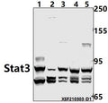 Western blot (WB) analysis of Stat3 pAb at 1:1000 dilution
Lane1:H9C2 whole cell lysate(40ug)
Lane2:AML-12 whole cell lysate(40ug)
Lane3:MCF-7 whole cell lysate(40ug)
Lane4:THP-1 whole cell lysate(40ug)
Lane5:HepG2 whole cell lysate(40ug)