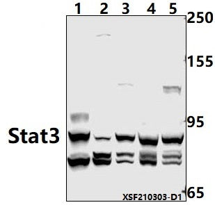 Western blot (WB) analysis of Stat3 pAb at 1:1000 dilution
Lane1:H9C2 whole cell lysate(40ug)
Lane2:AML-12 whole cell lysate(40ug)
Lane3:MCF-7 whole cell lysate(40ug)
Lane4:THP-1 whole cell lysate(40ug)
Lane5:HepG2 whole cell lysate(40ug)