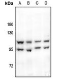 Western blot (WB) analysis of HSL (P548) polyclonal antibody at 1:500 dilution
Lane1:HEK293T whole cell lysate
Lane2:Raw264.7 whole cell lysate
Lane3:PC12 whole cell lysate