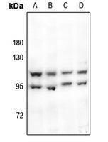 Western blot (WB) analysis of HSL (P548) polyclonal antibody at 1:500 dilution
Lane1:HEK293T whole cell lysate
Lane2:Raw264.7 whole cell lysate
Lane3:PC12 whole cell lysate
