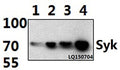 Western blot (WB) analysis of Syk (P342) polyclonal antibody at 1:1000 dilution
Lane1:THP-1 whole cell lysate(30ug)
Lane2:Jurkat whole cell lysate(30ug)
Lane3:RAW264.7 whole cell lysate(30ug)
Lane4:PC12 whole cell lysate(30ug)