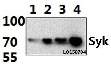 Western blot (WB) analysis of Syk (P342) polyclonal antibody at 1:1000 dilution
Lane1:THP-1 whole cell lysate(30ug)
Lane2:Jurkat whole cell lysate(30ug)
Lane3:RAW264.7 whole cell lysate(30ug)
Lane4:PC12 whole cell lysate(30ug)
