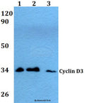 Western blot (WB) analysis of Cyclin D3 (G277) polyclonal antibody at 1:500 dilution
Lane1:HEK293T whole cell lysate
Lane2:Raw264.7 whole cell lysate
Lane3:H9C2 whole cell lysate