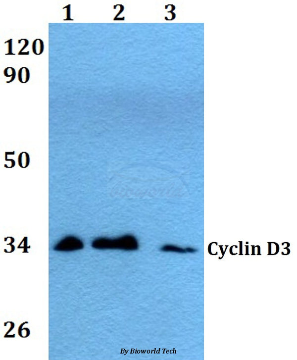 Western blot (WB) analysis of Cyclin D3 (G277) polyclonal antibody at 1:500 dilution
Lane1:HEK293T whole cell lysate
Lane2:Raw264.7 whole cell lysate
Lane3:H9C2 whole cell lysate