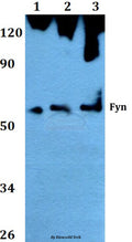 Western blot (WB) analysis of Fyn (T524) polyclonal antibody at 1:500 dilution
Lane1:Hela whole cell lysate
Lane2:NIH-3T3 whole cell lysate
Lane3:PC12 whole cell lysate