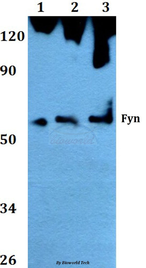 Western blot (WB) analysis of Fyn (T524) polyclonal antibody at 1:500 dilution
Lane1:Hela whole cell lysate
Lane2:NIH-3T3 whole cell lysate
Lane3:PC12 whole cell lysate