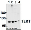 Western blot (WB) analysis of TERT (I820) pAb at 1:500 dilution
Lane1:MCF-7 whole cell lysate(40ug)
Lane2:H1792 whole cell lysate(40ug)
Lane3:The Thymus tissue lysate of Rat(40ug)
Lane4:The Lung tissue lysate of Mouse(40ug)