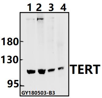 Western blot (WB) analysis of TERT (I820) pAb at 1:500 dilution
Lane1:MCF-7 whole cell lysate(40ug)
Lane2:H1792 whole cell lysate(40ug)
Lane3:The Thymus tissue lysate of Rat(40ug)
Lane4:The Lung tissue lysate of Mouse(40ug)