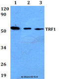 Western blot (WB) analysis of TRF1(L215) polyclonal antibody at 1:500 dilution
Lane1:HEK293T whole cell lysate
Lane2:Raw264.7 whole cell lysate
Lane3:H9C2 whole cell lysate