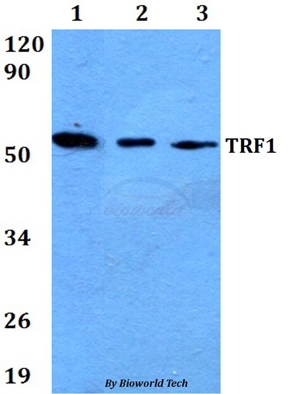 Western blot (WB) analysis of TRF1(L215) polyclonal antibody at 1:500 dilution
Lane1:HEK293T whole cell lysate
Lane2:Raw264.7 whole cell lysate
Lane3:H9C2 whole cell lysate