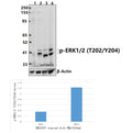 Western blot (WB) analysis of ERK1/2 (Phospho-T202/Y204) polyclonal antibody at 1:5000 dilution
Lane1:HEK293T whole cell lysate(40ug)
Lane2:HEK293T treated with PMA(200nM, 10 min) whole cell lysate(40ug)
Lane3:BV2 whole cell lysate(40ug)
Lane4:C6 whole cell lysate(40ug)