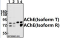 Western blot (WB) analysis of AChE pAb at 1:500 dilution
Lane1:K562 whole cell lysate(40ug)
Lane2:SGC7901 whole cell lysate(40ug)
Lane3:The Blood tissue lysate of Mouse(40ug)
Lane4:The Blood tissue lysate of Rat(40ug)