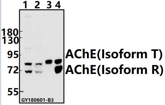 Western blot (WB) analysis of AChE pAb at 1:500 dilution
Lane1:K562 whole cell lysate(40ug)
Lane2:SGC7901 whole cell lysate(40ug)
Lane3:The Blood tissue lysate of Mouse(40ug)
Lane4:The Blood tissue lysate of Rat(40ug)