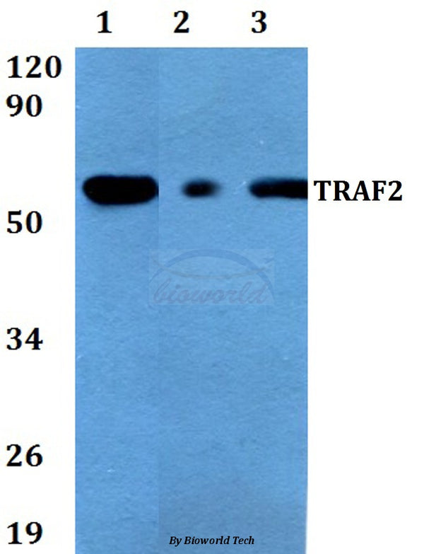 Western blot (WB) analysis of TRAF2 (S11) polyclonal antibody at 1:500 dilution
Lane1:HEK293T whole cell lysate
Lane2:Raw264.7 whole cell lysate
Lane3:PC12 whole cell lysate