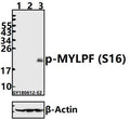 Western blot (WB) analysis of p-MYLPF (S16) pAb at 1:500 dilution
Lane1:HEK293T whole cell lysate(40ug)
Lane2:K562 whole cell lysate(40ug)
Lane3:The Muscle tissue lysate of Rat(40ug)